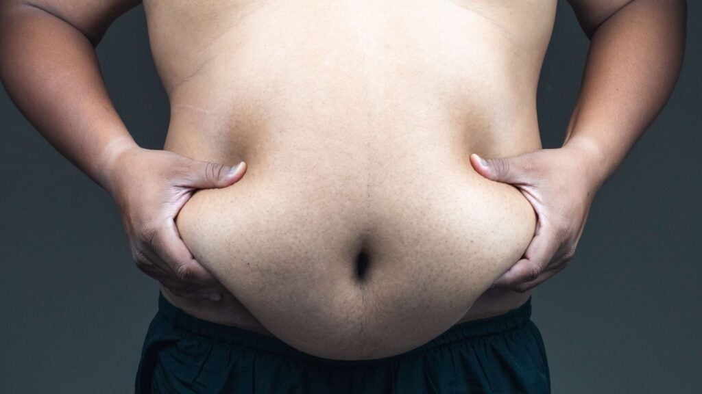 Torso of an overweight person grabbing their excess fat
